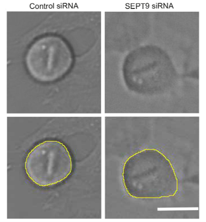 FocalPlane (@focalplane_jcs) on Twitter photo It’s #WhiteLightWednesday and today we’ll zoom in on work from <a href="/NezaVadnjal/">Neza Vadnjal</a> <a href="/PaluchLab/">Ewa Paluch 🇺🇦</a> at <a href="/LMCB_UCL/">UCL Laboratory for Molecular Cell Biology</a> and <a href="/PDN_Cambridge/">PDN Cambridge</a>, published in <a href="/J_Cell_Sci/">J Cell Science</a>, showing that septin 9 is an important regulator of cell rounding at the onset of mitosis.
📖 Publication: doi.org/10.1242/jcs.25… It’s #WhiteLightWednesday and today we’ll zoom in on work from <a href="/NezaVadnjal/">Neza Vadnjal</a> <a href="/PaluchLab/">Ewa Paluch 🇺🇦</a> at <a href="/LMCB_UCL/">UCL Laboratory for Molecular Cell Biology</a> and <a href="/PDN_Cambridge/">PDN Cambridge</a>, published in <a href="/J_Cell_Sci/">J Cell Science</a>, showing that septin 9 is an important regulator of cell rounding at the onset of mitosis.
📖 Publication: doi.org/10.1242/jcs.25…