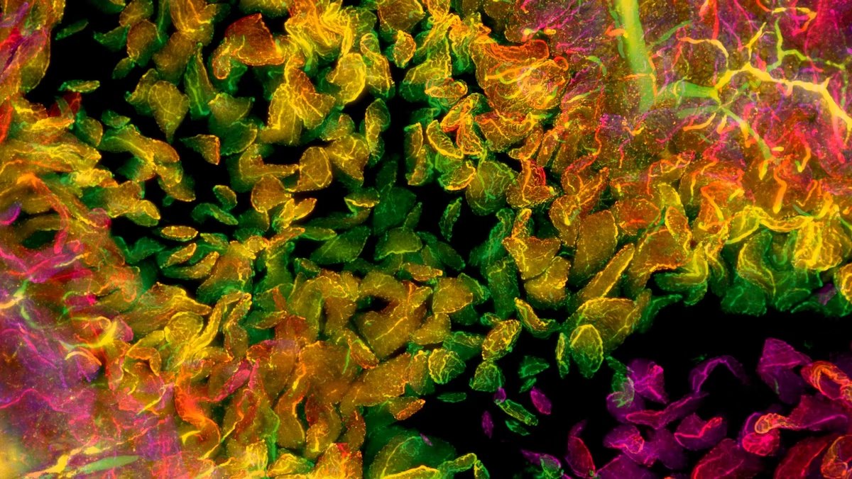 Microscopy&Analysis (@microscopyviews) on Twitter photo Exploring the gut-brain connection - <a href="/wyssinstitute/">Wyss Institute</a> researchers are using new neurotechnologies and light sheet microscopy to understand how gut health affects brain function. #microscopy #imaging #brain #neuroscience
analyticalscience.wiley.com/do/10.1002/was… Exploring the gut-brain connection - <a href="/wyssinstitute/">Wyss Institute</a> researchers are using new neurotechnologies and light sheet microscopy to understand how gut health affects brain function. #microscopy #imaging #brain #neuroscience
analyticalscience.wiley.com/do/10.1002/was…