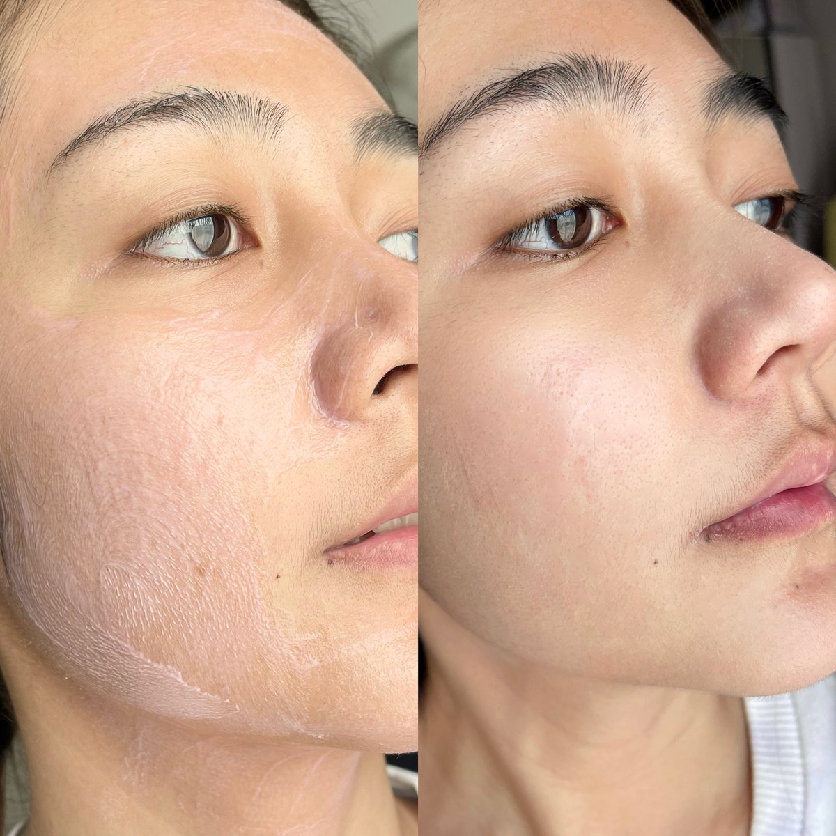 luknamyani's tweet photo. ลองแล้วดีมาก! น้องเป็นมาสก์ดีท็อกซ์ผิว #SKINTOX ของ #TOUCHAA น้องช่วยผลัดเซลล์ผิว เนื้อเค้าจะเป็นสครับสีชมพู💕 ลูกน้ำใช้วันละซอง 3 วันติดต่อกัน มาสก์ทิ้งไว้ 5-15 นาที หลังล้างคือหน้ากระจ่างใสขึ้นมากเลยอะ #ใช้ดีบอกต่อ https://t.co/9u8JG22CKQ