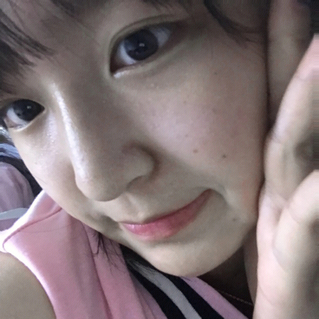 chn66993's tweet photo. 脸上长斑了😭 https://t.co/FmGWX3dx58