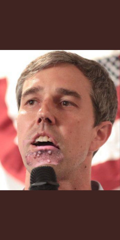 shieldss930's tweet image. Robert caught herpes after a night partying with Tina.