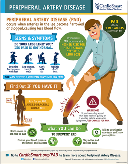 ACCinTouch's tweet photo. Peripheral artery disease (#PAD) affects 1 in 8 adults age 60+, &amp; while leg pain/cramps can be a sign of the disease, 40% of PAD patients do not 🚫 have leg pain at all. 

Share this #CardioSmart infographic w/ your patients for #PADAwareness Month: https://t.co/FOX2Gai1hj https://t.co/otykBBAkUT