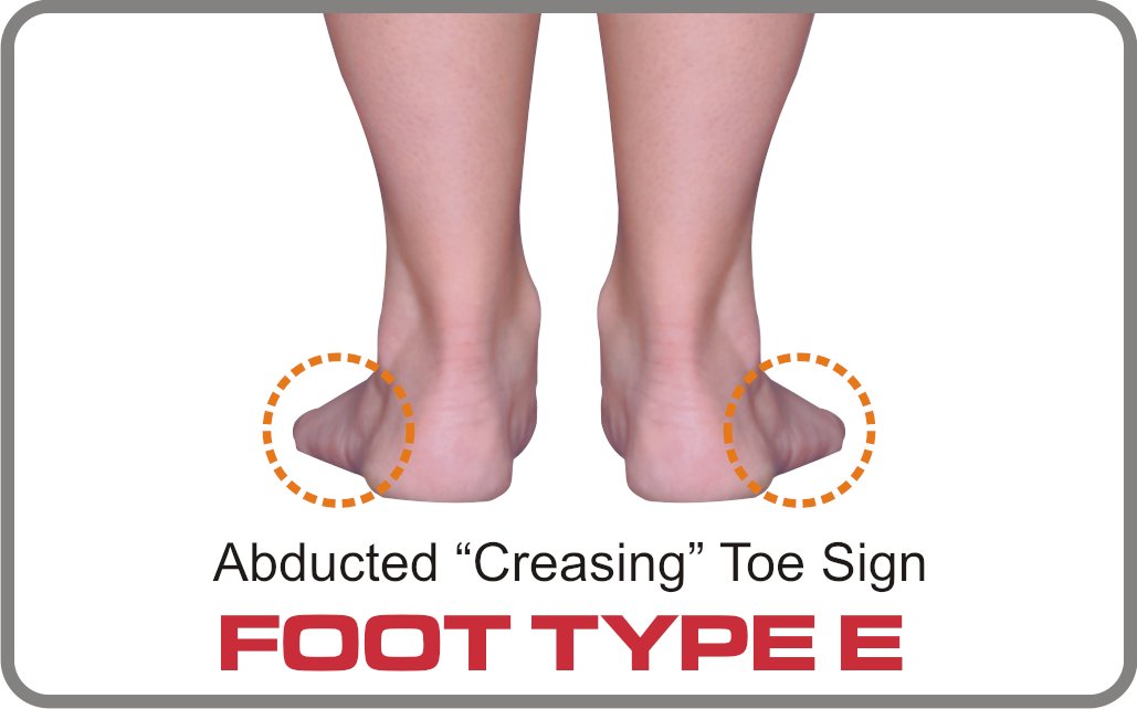 Nolaro24LLC's tweet photo. The E Quad is the most destructive foot type. Dr. Louis J DeCaro has published a new article on The Evolution and Treatment of the E Foot Type in Podiatry Management, read about how to recognize it in children and what you can do about it.
https://t.co/JTBDODEvYF https://t.co/dty4HWPRg2