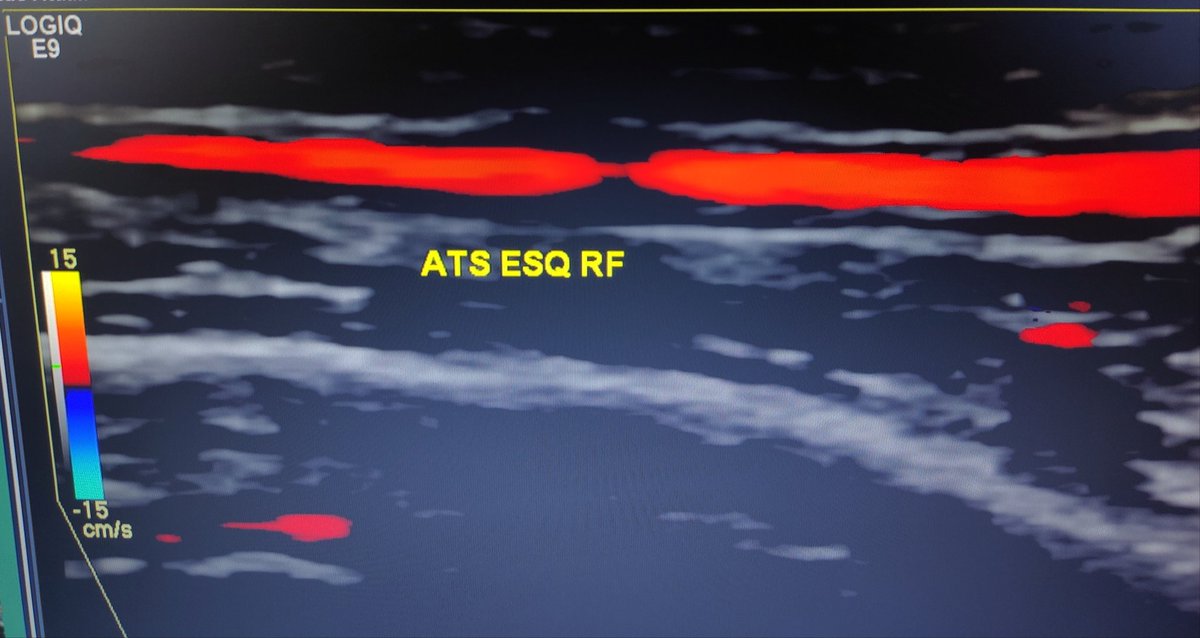Neurosonology Lab - LHC tweet media