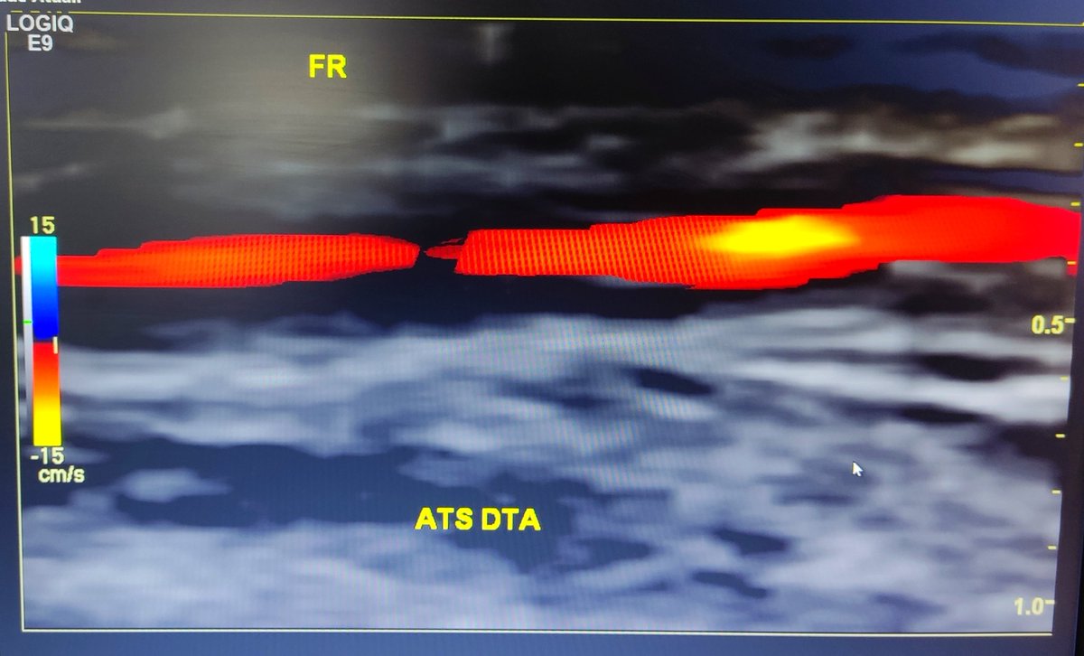 Neurosonology Lab - LHC tweet media