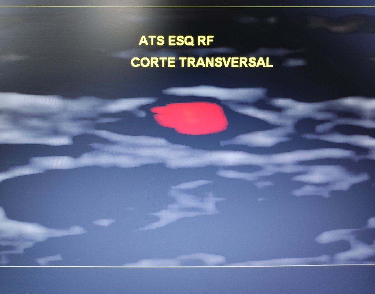 Neurosonology Lab - LHC tweet media