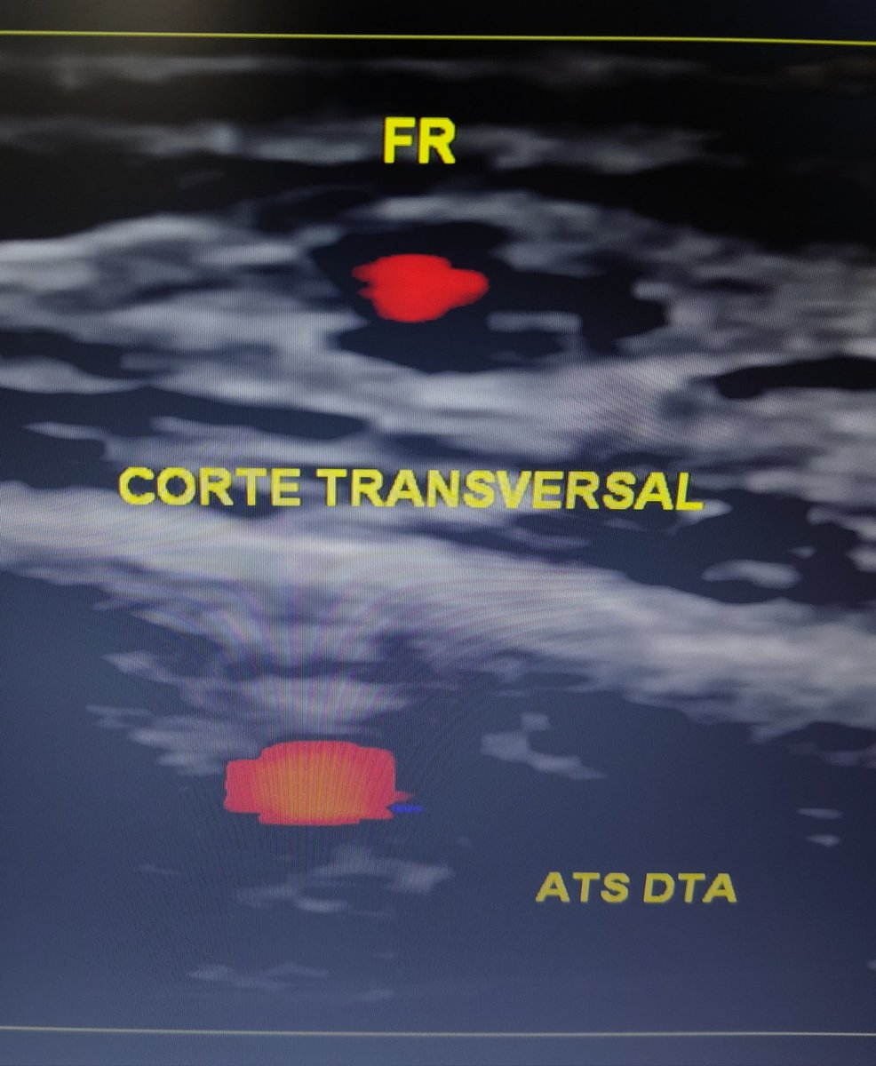 Neurosonology Lab - LHC tweet media