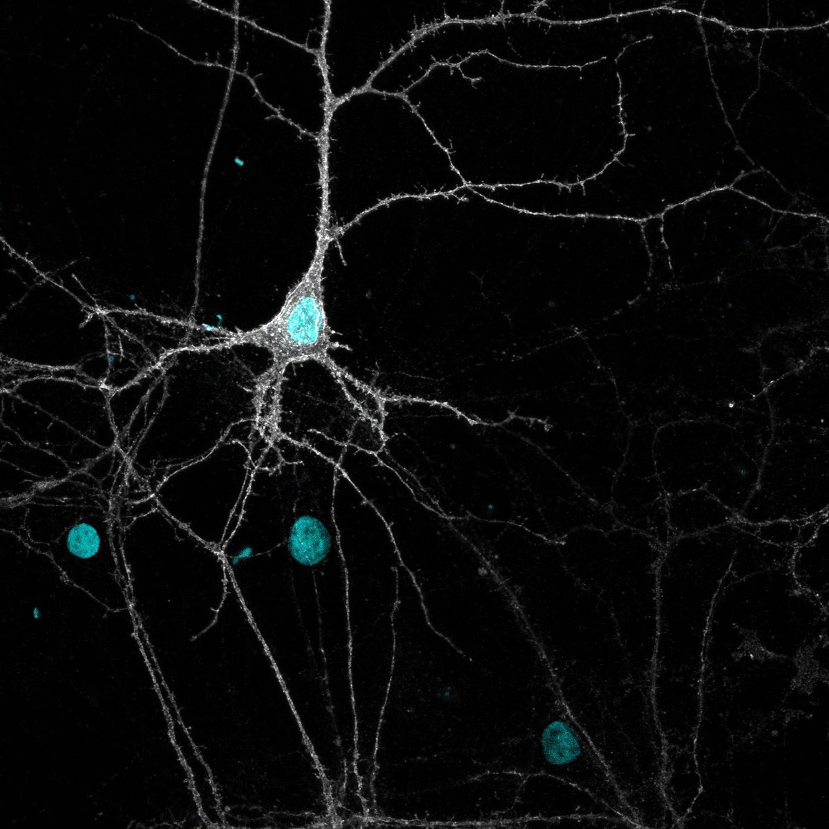 jkeram7's tweet photo. Imaging cortical #neurons in culture immunostained against the potassium-chloride co-transporter #KCC2 and I couldn’t resist from sharing this beauty ☺️ #ydklab #PCN_CERVO @CERVO_ULaval https://t.co/dnk76qtXpI