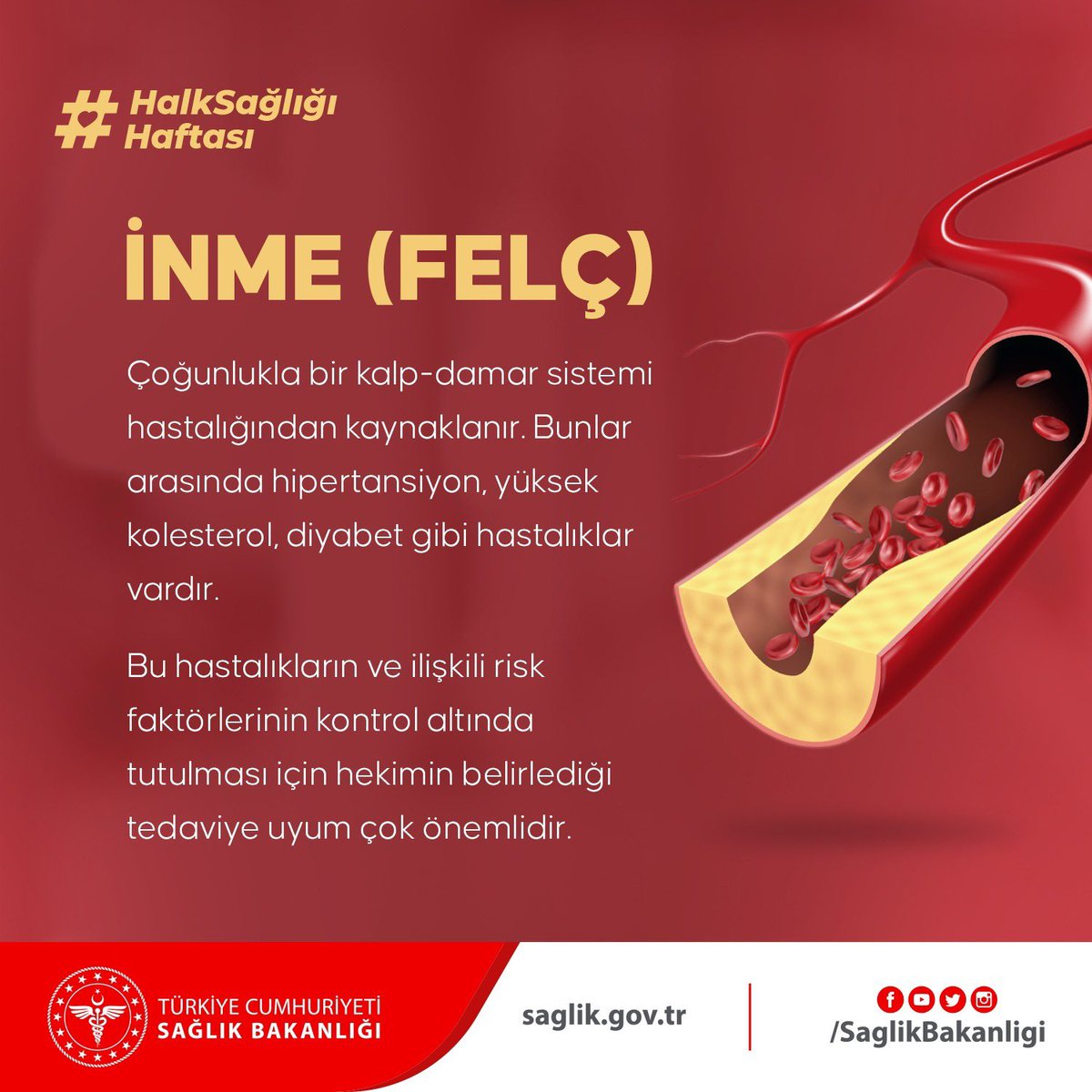 İNME (FELÇ) NEDİR?
Bilgi edinmek için bit.ly/3AKoCUJ linkinde yer alan broşürü inceleyebilirsiniz.
#HalkSağlığıHaftası
#KronikHastalıkTakibi