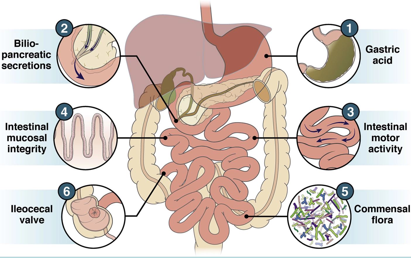 Tuberculos intestino