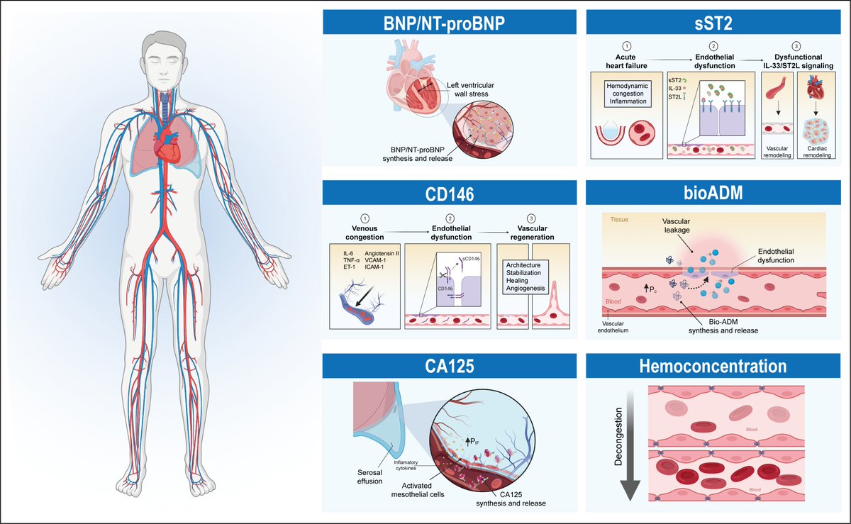 Congestion in #heartfailure: a circulating biomarker-based perspective. A review from the Biomarkers Working Group of the Heart Failure Association, ESC. Pleased and honored to be part of this excellent manuscript. @yulnunezvill & Antoni Bayes-Genis @ESC_Journals