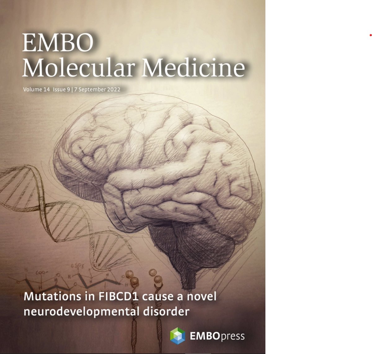 Lab_Nagy's tweet photo. We are incredibly proud to have our latest paper highlighted on the cover of @embomolmed where we describe a novel #ECM receptor in the brain and the causality of its variants in a rare #neurodevelopmentaldisorder. #raredisease #autism #glycosaminoglycans #neuroscience a🧵 https://t.co/gfMrR9mHHt