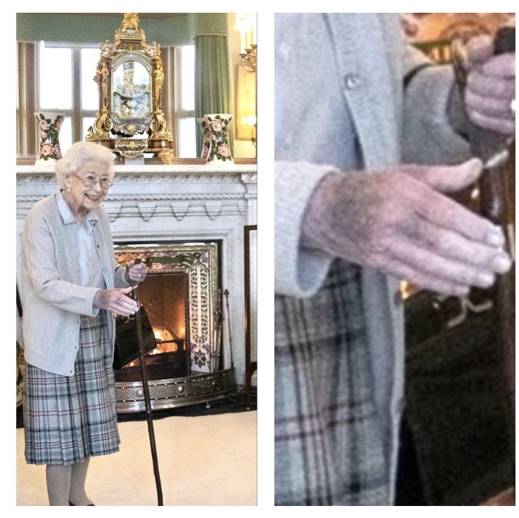 _Genevieves_'s tweet image. Anyone else concerned at the sight of the Queen’s hand? 😳 especially as Lady C said she’s been “affected to the bones”
Harry - we won’t forget what you did to your own grandparents. Your loyalties should be with those who’ve been there all along SMH!