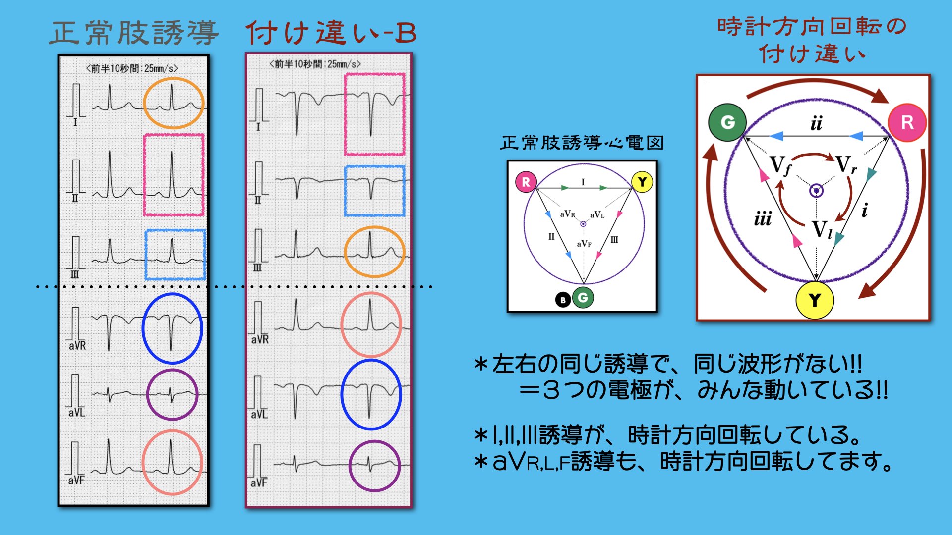 N. Tsukishima EP大学心電図検定学部試験対策科担任 on X N. Tsukishima EP大学心電図検定学部試験対策科担任 on X