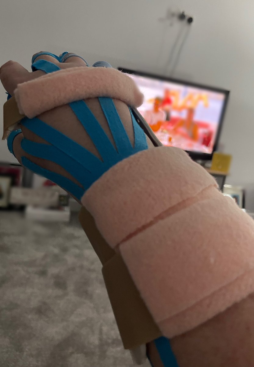 nichola_daly's tweet photo. Never underestimate the journey back from broken and dislocated bones 🥴🦴 #twomonthslater https://t.co/k1lBz6QZBv