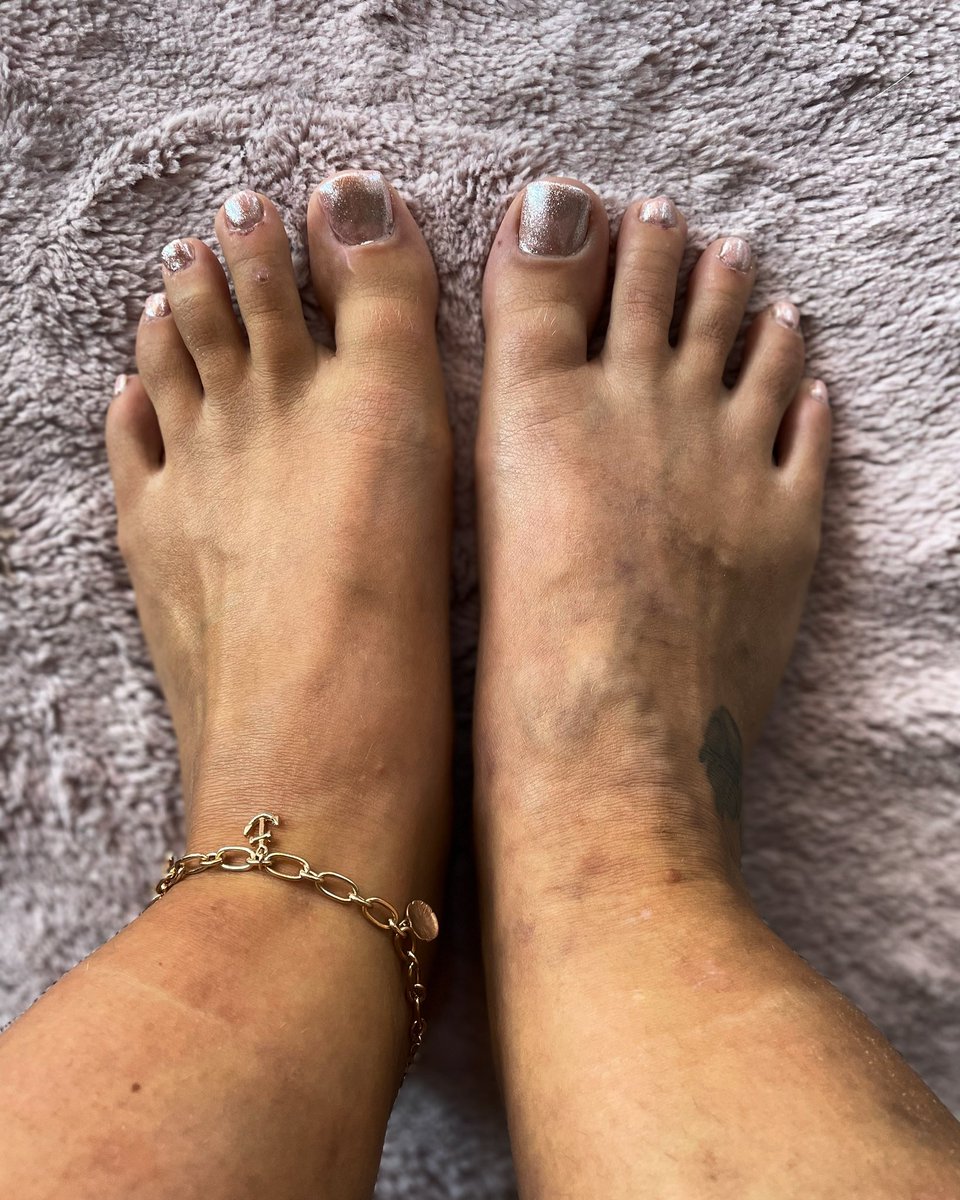 hotfeetpics41's tweet photo. Hey there 🔥
DM me for privat pic‘s 😉
check out my onlyfans:
https://t.co/7A8Vq9o29J
#hot #hotfeets #toe #nails #sole #feetfethish #onlyfansgirl #onlyfanspromo #onlyfans #feetpicsforsales #feetvideos #daddy https://t.co/UiQ7Eg4luf