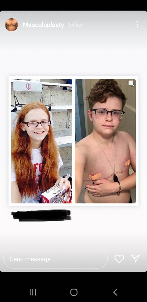 Chloe Cole ⭐️ tweet media