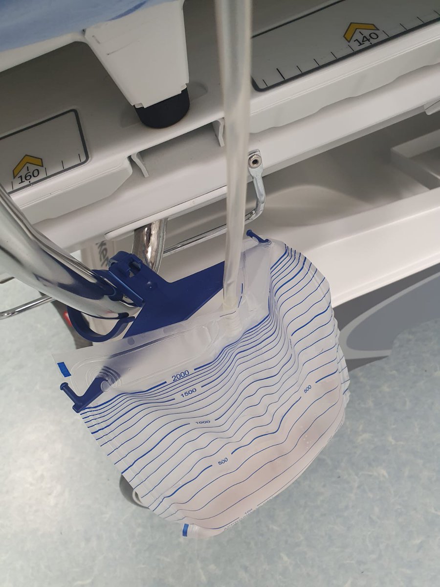 DocGauhar's tweet photo. @FCAFigueiredo @fgomsan @trwherrmann @MSGONZALEZURO @BernardoNor9 @KarinLehrich @amy_krambeck @scoffonecesare @chuikalun1 @mzawadzk1 @jfunkmd In my case yday 😅 my colleague @doc_sarvajit tackled beautifuly keeping @fgomsan &amp; ur principles&amp; techniques  90gm on anticoagulant with this #EnBlock with #earlyapicalrelease &amp; #MOSES 
Pt &amp; surgeon 🏆 
23hr cath off &amp; home https://t.co/MH0HoJcdWF