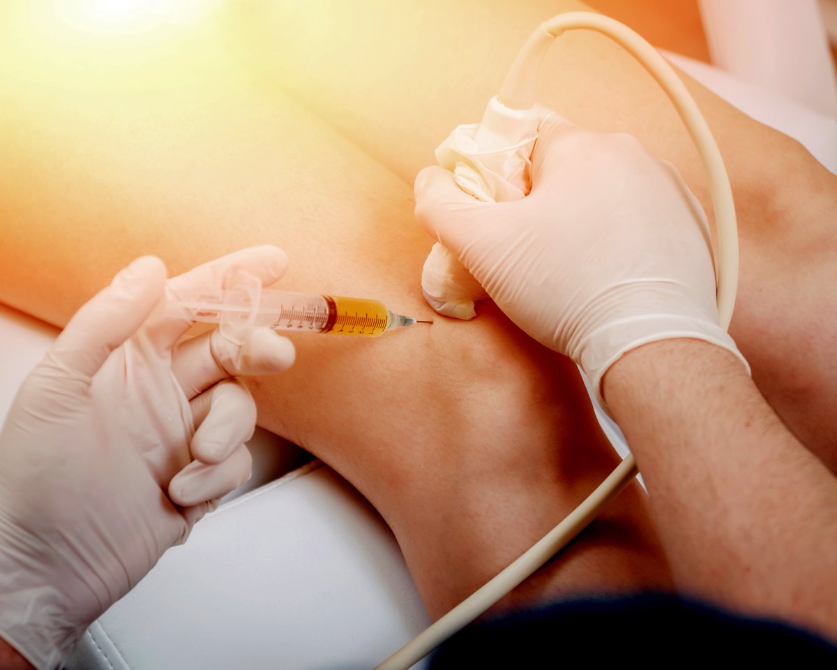 ASA commissioned research on the evaluation of sonographers administering ultrasound-guided musculoskeletal injections. Further information can be found on our website. loom.ly/UgRx84s
#SupportingSonographers