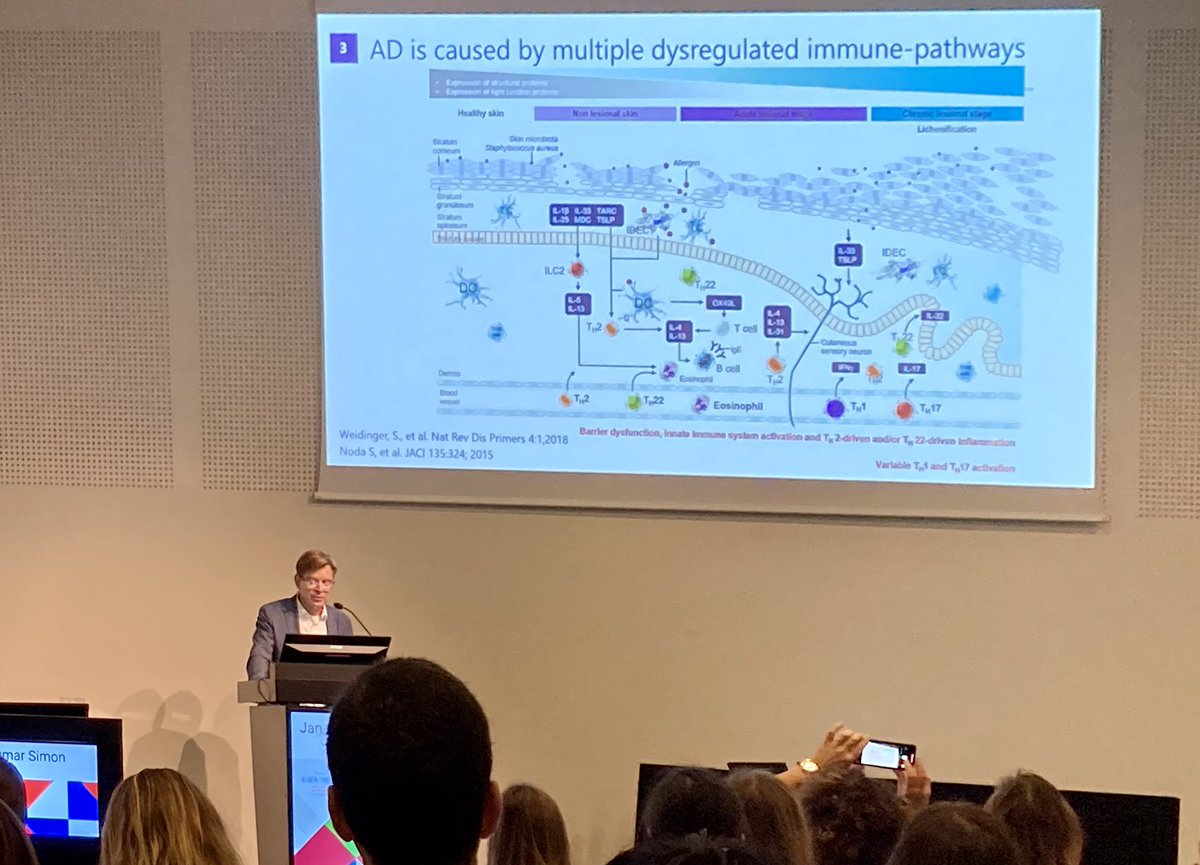 EVandersichel's tweet photo. A clear overview of the #atopicDermatitis inflammatory pathway by Prof. Jan Gutermuth @eadv in #Milan https://t.co/nIuOzgYy7J