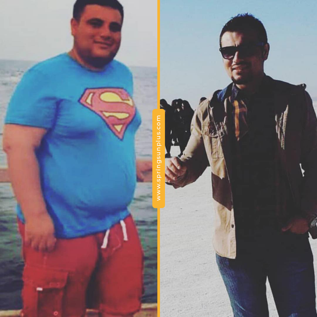 springsunplus's tweet photo. Bariatric Surgery in Turkey#bariatricsurgeryturkey #gastricsleeve #obesitysurgery #bariatrischechirurgie #chirurgiebariatrique #cirugiabariatrica #springsunplus #turkey #healthtourism https://t.co/BaGhoUeACc