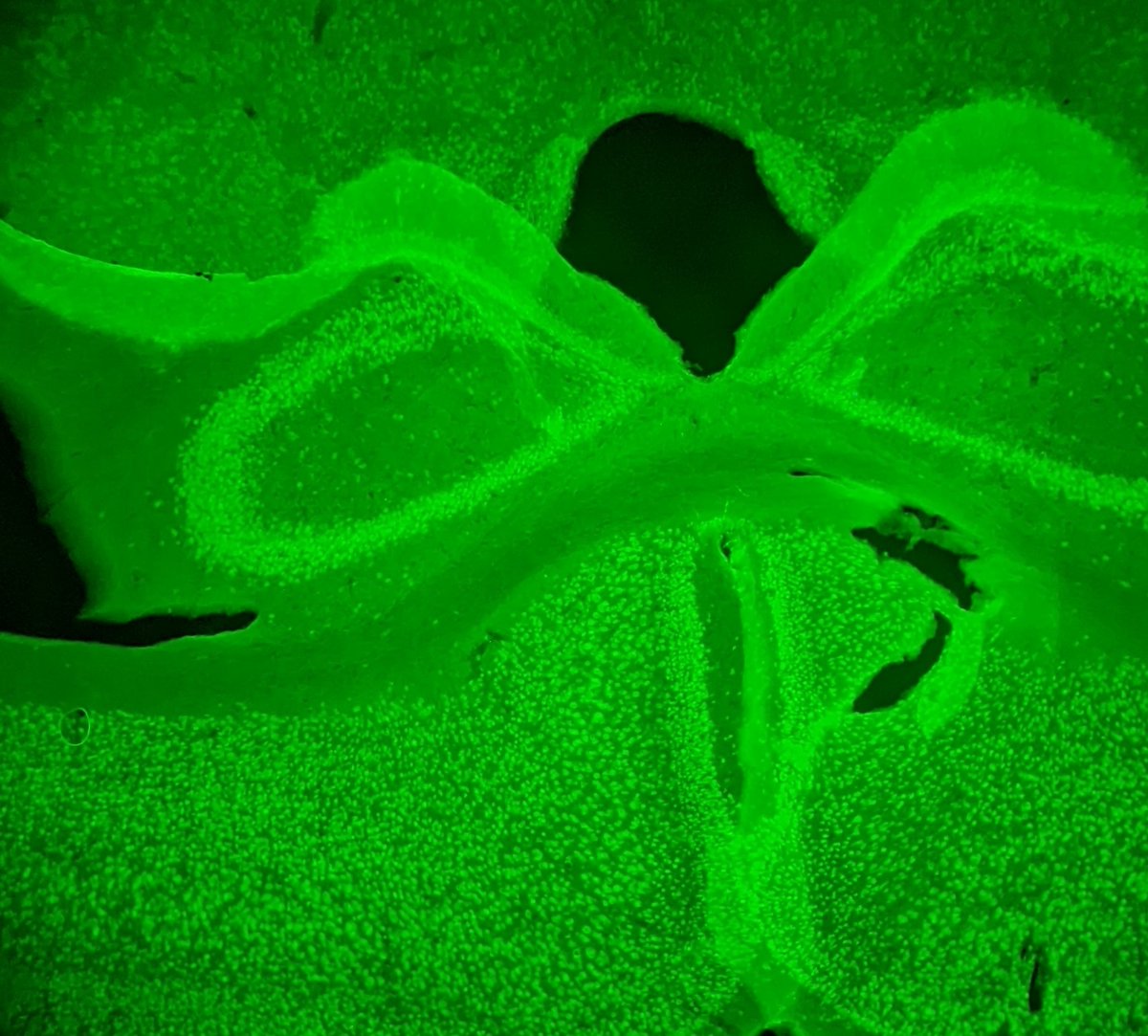 tate_askey's tweet photo. I will never get over how pretty GFAP and NeuN staining is 😍 #Biology #Microscopy https://t.co/KSm6PLpXi0
