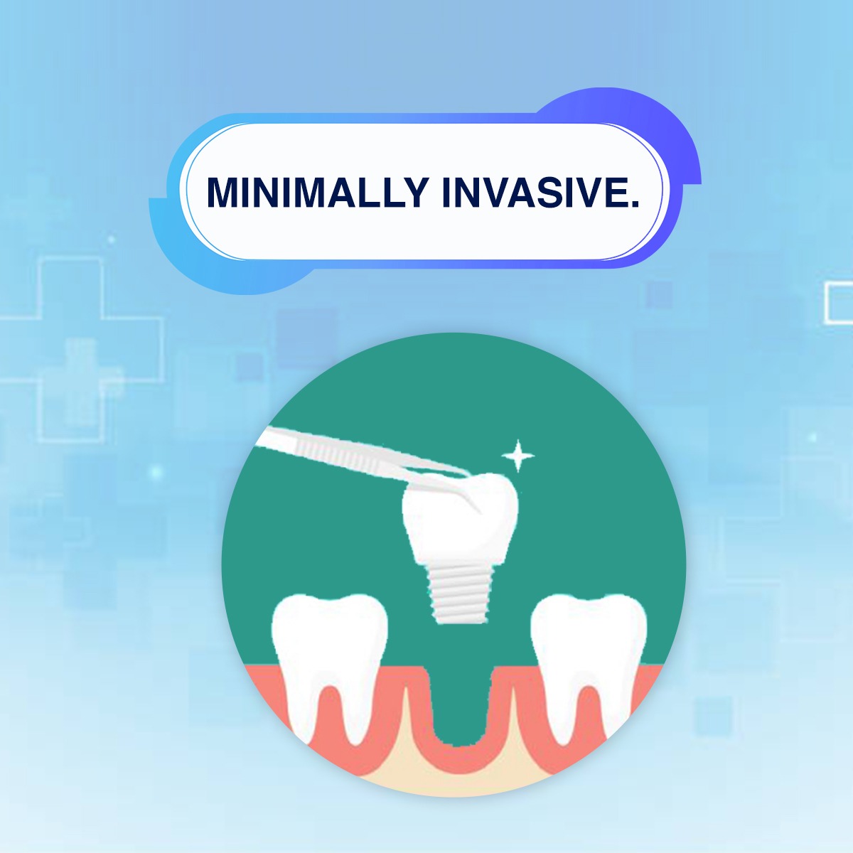 LuxmiDental's tweet photo. Magnification in dentistry acts like the right amount of salt in your toothpaste!
Book your slots today.
📞 9068623405, 9719115405
Luxmi Dental Clinic, F4, Nehru Colony, Near Rispana Bridge, Dehradun
#dehradun #uttarakhand #luxmidentalclinic #dentistindehradun #microdentistry https://t.co/6aWr1zV2oG