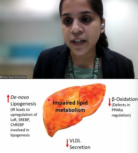 MGWacker's tweet photo. Today, at our seminar Bhave Sayali Shrivardhan shared the insights she gained on NAFLD while pursuing her Ph.D. in the NUS Pharmacy Graduate Programme. Smart young minds are shaping the world! #NUSDeparmentOfPharmacy #Science #PharmacyResearchSeminars #PeopleDoTheScience https://t.co/1AwRm3HAVk