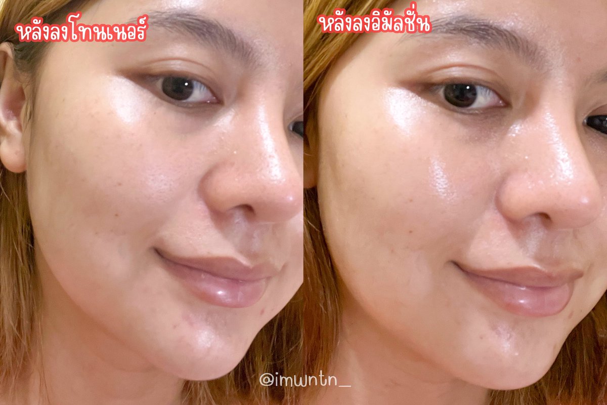 imwntn_'s tweet photo. วันนี้จะมาแนะนำ #โทนเนอร์น้ำตบแตงโม ช่วยเพิ่มความชุ่มชื้นให้กับผิวถึง 90% และยังช่วยปรับสภาพผิวให้เรียบเนียน ใช้คู่กับ #อิมัลชั่นแตงโม ที่ช่วยลดการระคายเคืองของผิวจากแสงแดด ช่วยปรอบประโลมผิว ใช้มาอาทิตย์นึงรู้สึกว่าผิวเรียบเนียนขึ้น นุ่มขึ้นด้วย(ต่อ) #BTFarmskin #ใช้จริงรีวิวจริง https://t.co/fYj68PNXOo
