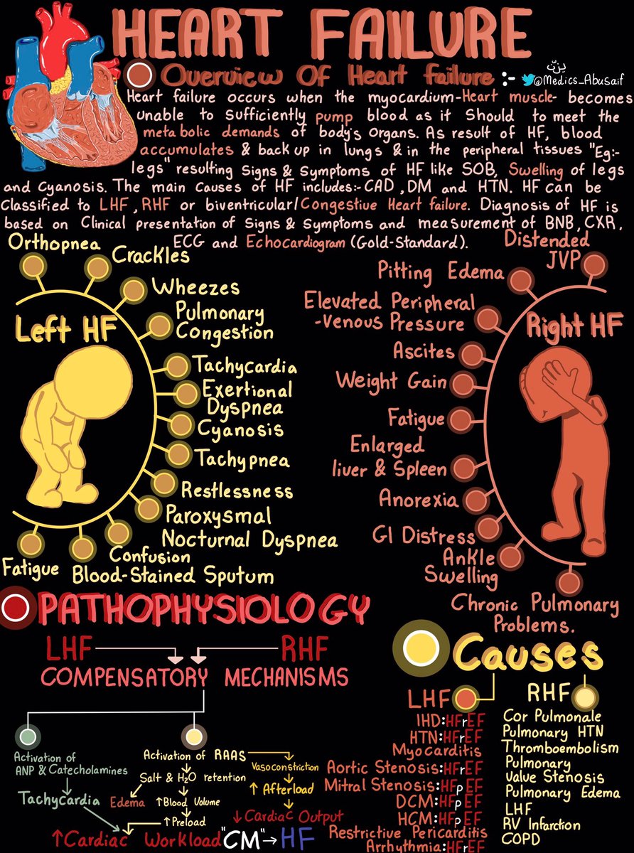 BrownJHM's tweet photo. Congestive heart failure @medics_AbuSaif #BJHM #MedEd #Medtwitter https://t.co/3WRxjjSQR1