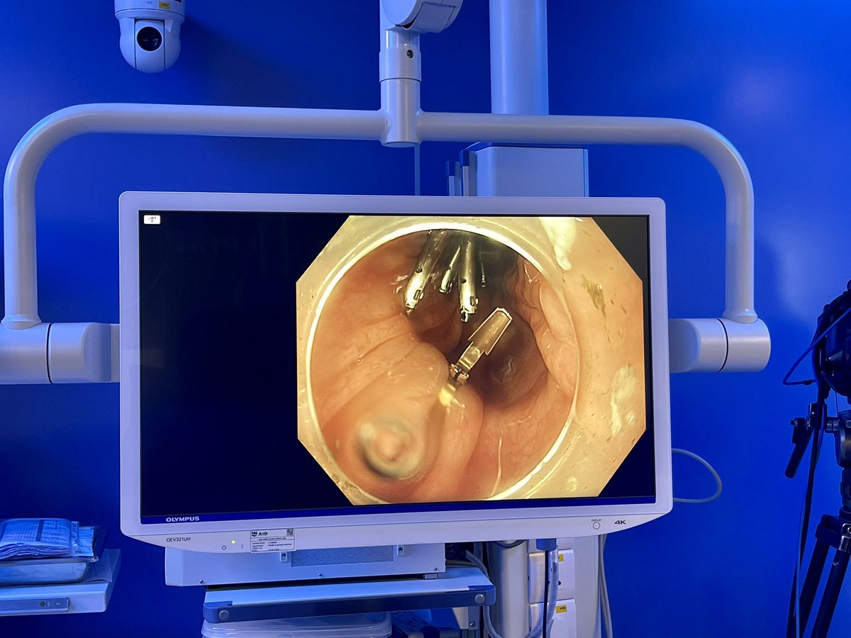 Fantastic start of Endocon 2022, the much awaited Endoscopy Bonanza! 
Proud moment to share the stage with my good friend &amp; skilled Endoscopist Philip Chiu for the opening case of the course! 
Thank you Team AIG for the invitation &amp; honour!
