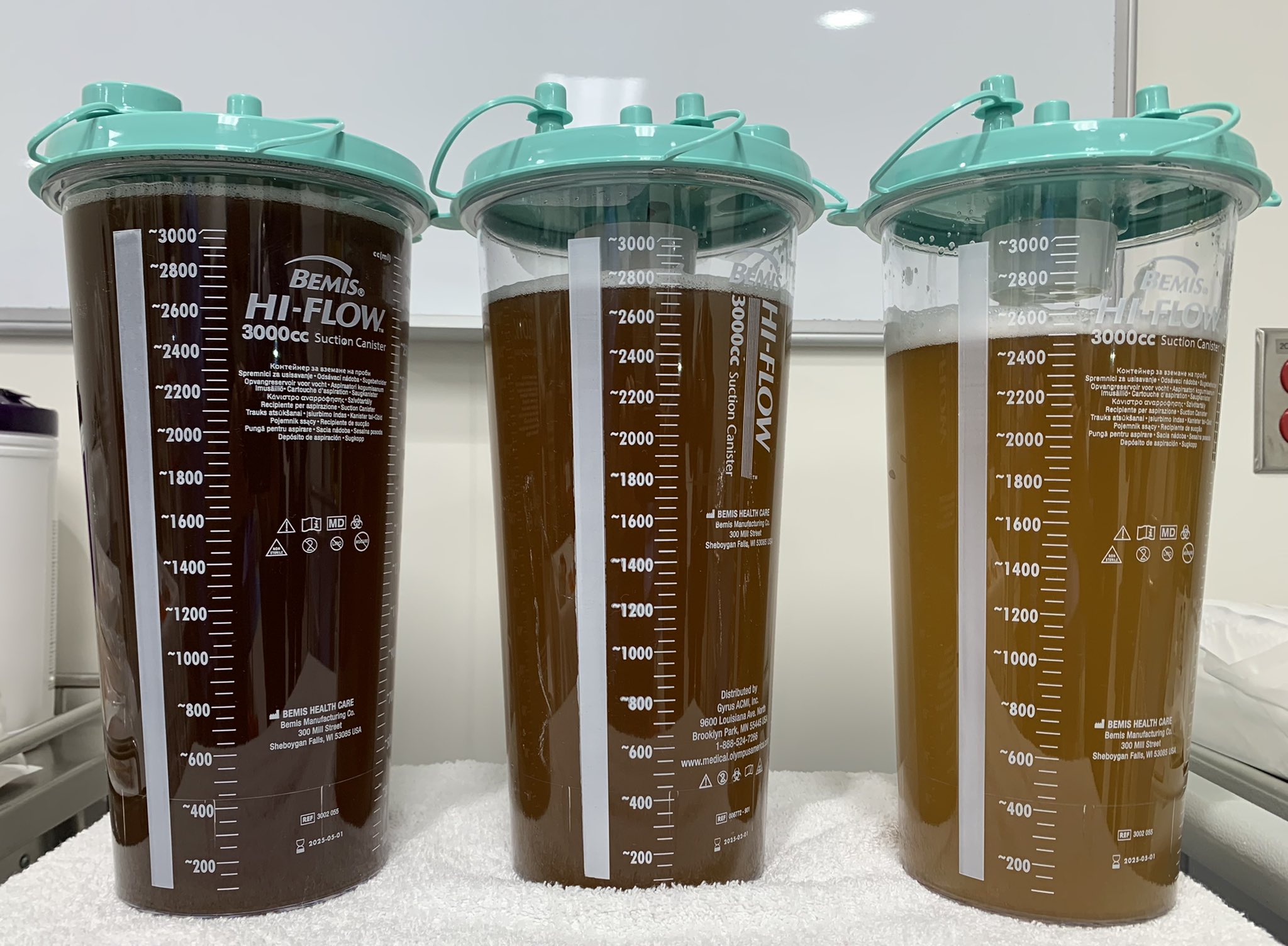 Amniotic Fluid Color