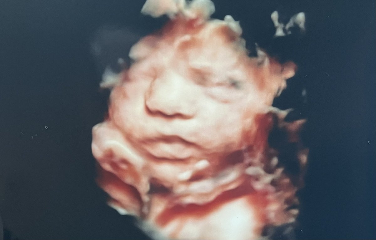 baileymdarnell's tweet photo. 7ish more weeks until i get to kiss these chunky cheeks!! 🥺 https://t.co/qeMaMJw7Tv
