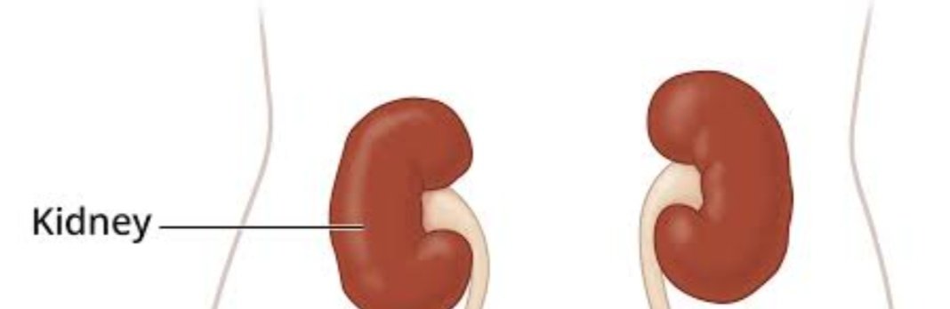 CA_HarshilSHETH's tweet photo. So @anikjaindesign has Redesigned Apple logo
Introducing Kidney to end all kidney jokes now
Deadly epic 😂
#AppleEvent
#AppleEvent2022
#apple14pro https://t.co/bV8isctnjA