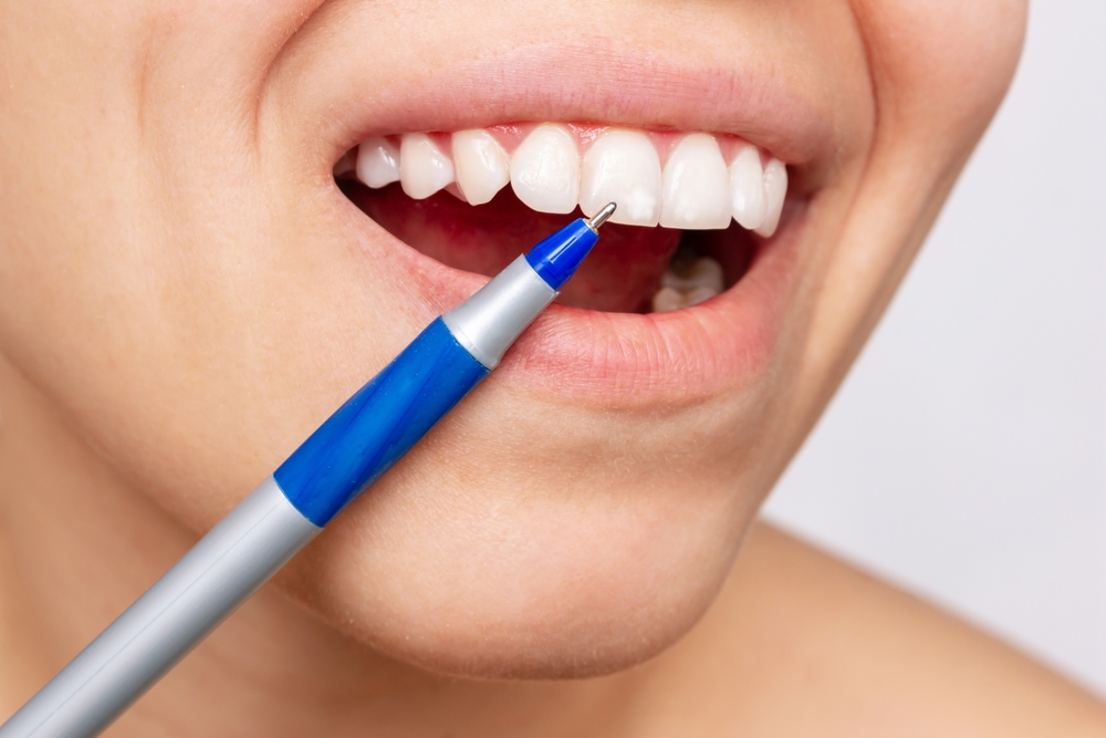 DentistryMorgan's tweet photo. There are many causes of white spots on your teeth, though sometimes they can be hard to determine. Click here to learn some of the common causes: https://t.co/tQgP0icInd https://t.co/0jlEpE07ye