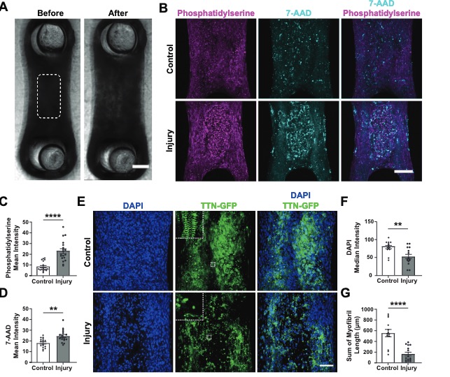 ajpheartcirc's tweet image. #ArticlesInPress: Mechanical response of cardiac #microtissues to acute localized injury
Shoshana L. Das, Bryan P. Sutherland, Emma Lejeune, Jeroen Eyckmans, and Christopher S. Chen
ow.ly/6SuC50KElcO
@LejeuneLab  @mit_hst 
#cardiacTissueEngineering