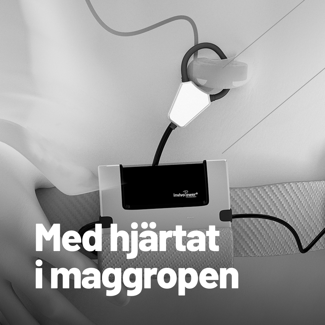 Artificiella hjärtan är snart så bra att de kanske kan ersätta hjärttransplantationer. Svenska Invivopower har patenterat ett sätt att strömförsörja hjärtan och hjärtpumpar som är bekvämare för patienterna och minskar belastningen på vården.

bit.ly/3RzdfWA