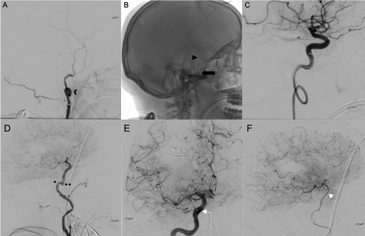 Russell Lonser, M.D. tweet media
