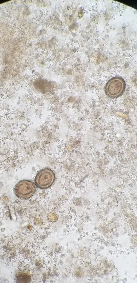 Parasite_Power's tweet photo. Fun find today. 
Iodine obscured these eggs. Prepped w/out iodine made all the features pop. Last two images are actually wet preps from PVA, unconcentrated, just for fun. This was loaded. 
Who am I? (Genus-level)
#parasitology 
@ParasiteGal https://t.co/S4zcdCjwI8
