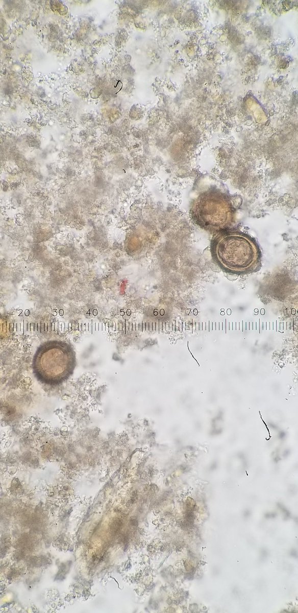 Parasite_Power's tweet photo. Fun find today. 
Iodine obscured these eggs. Prepped w/out iodine made all the features pop. Last two images are actually wet preps from PVA, unconcentrated, just for fun. This was loaded. 
Who am I? (Genus-level)
#parasitology 
@ParasiteGal https://t.co/S4zcdCjwI8