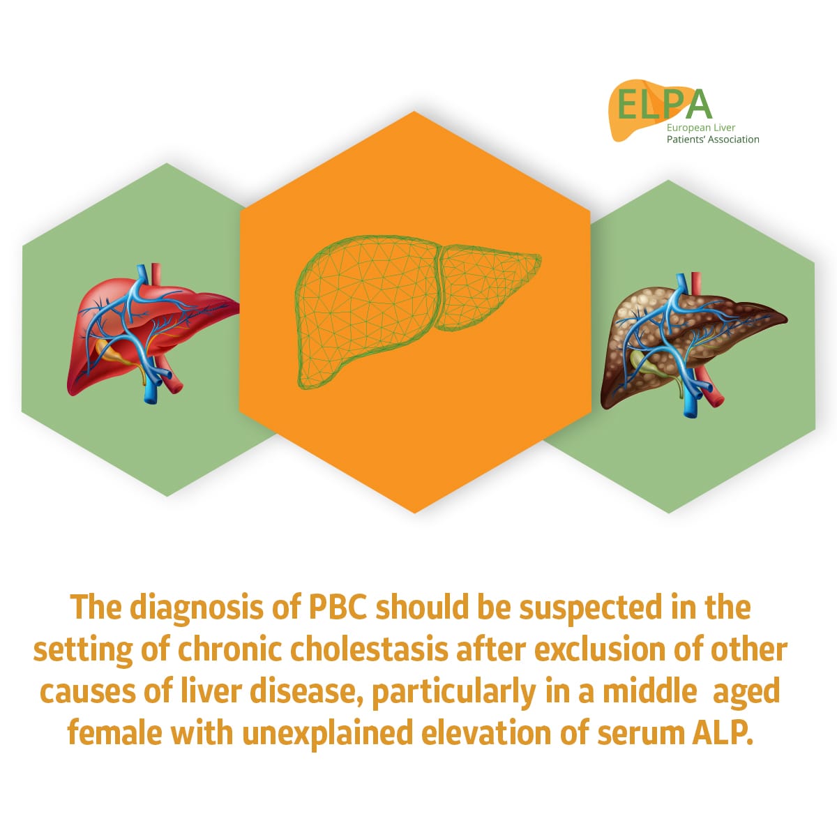 EuropeLiver's tweet photo. #PBCinternationalDay 
#RareLiverDiseases #PBC2022 @PBC_Canada @LIVER_PBC_NASH @pbcadvocate @pbcercarol @GlobalLiver @Marko_Korenjak #LiverCancerAwarnessMonth @MKDmilanM @BeaCredi @VeronikaVsetic @JHepatology @AASLDtweets @ERN_RARE_LIVER https://t.co/nmWJC86HZV