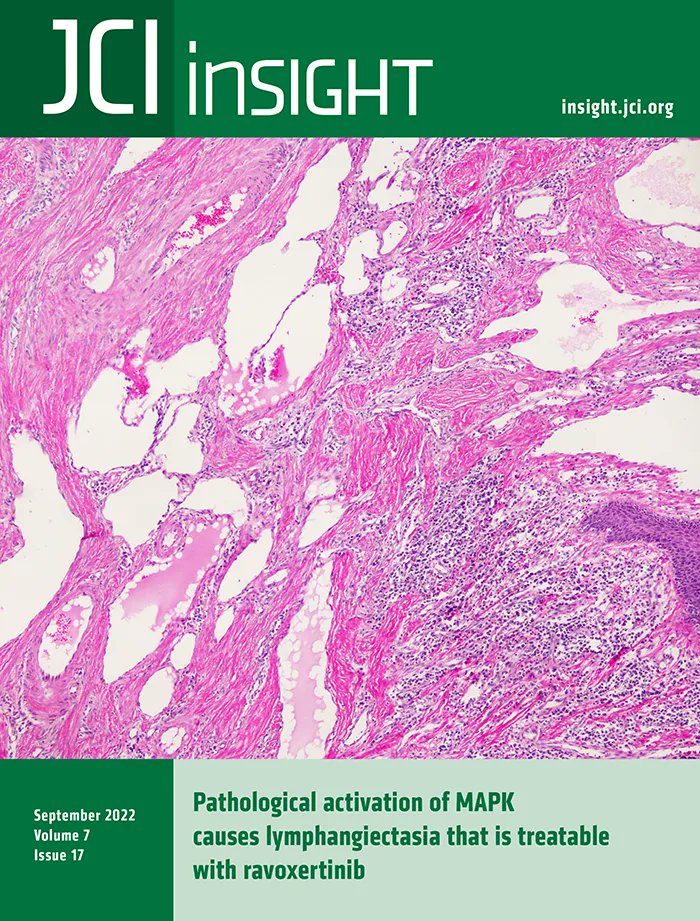 #Cover: Pathological activation of MAPK causes lymphangiectasia treatable with ravoxertinib: buff.ly/3RFn7y1 Image: H&E-stained pathological human tissue section that shows lymphangiectasia. @trivedilab @UMass_Medicine #Development #VascularBiology