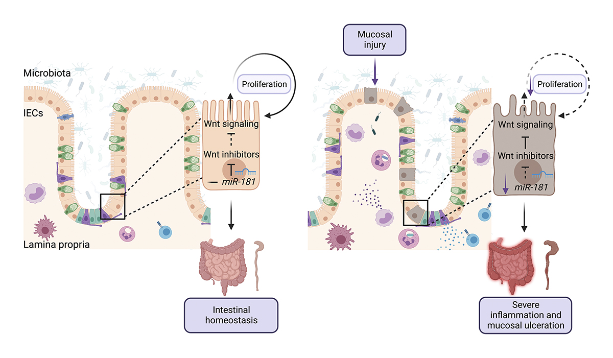 JExpMed's tweet photo. Jimenez, Henao-Mejia et al @Penn_IFI @PennPathLabMed show that the miR-181 family is downregulated in IECs from human #IBD patients and in mice w/ #colitis, a process that is critical for the development of severe colonic #inflammation https://t.co/HLKDfQdRAj
@megclarks @MFMich1 https://t.co/PPlG3WBLaK