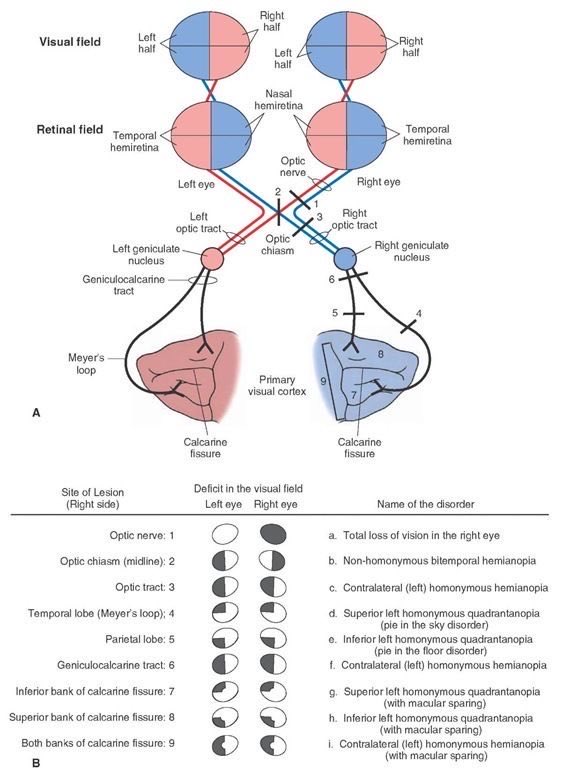 OGdukeneurosurg's tweet image. A great Optic Pathway and visual field defect primer h/t what-when-how.