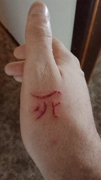 Decided to do a tattoo on myself. https://t.co/fquBgd8Bg2<a href="/tag/nogimmick"class="tags"><span>#nogimmick</span></a><a href="/tag/actualmagic"class="tags"><span>#actualmagic</span></a>