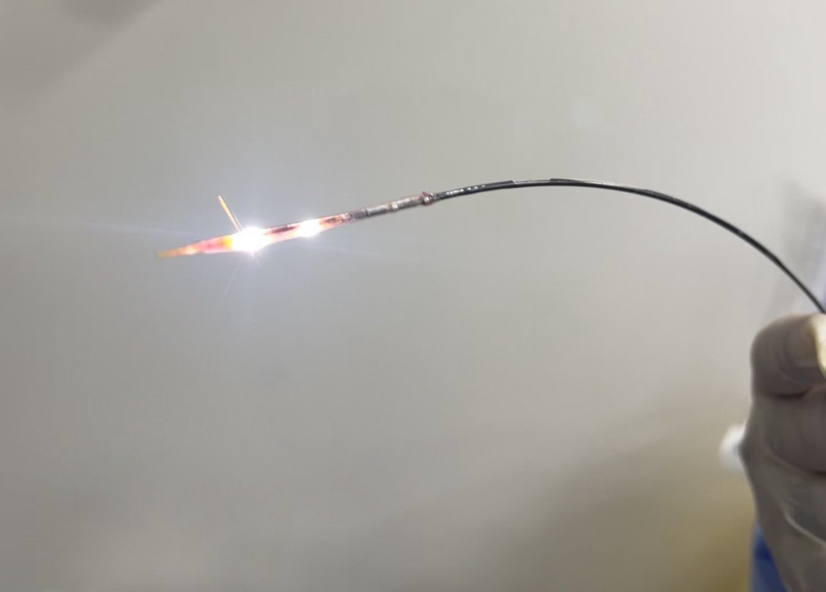 Adeebmsg's tweet image. توسيع تضيق شديد في شريان الساق الأمامي بنظام معالجة التكلسات داخل الأوعية الدموية والذي يحول الطاقة الكهربائية إلى طاقة ميكانيكية من خلال بالون منخفض الضغط يعتمد على الموجات بدون إصابة جدار الشرايين الطرفية.

#Shockwave angioplasty of the ATA
@ksmcmedia