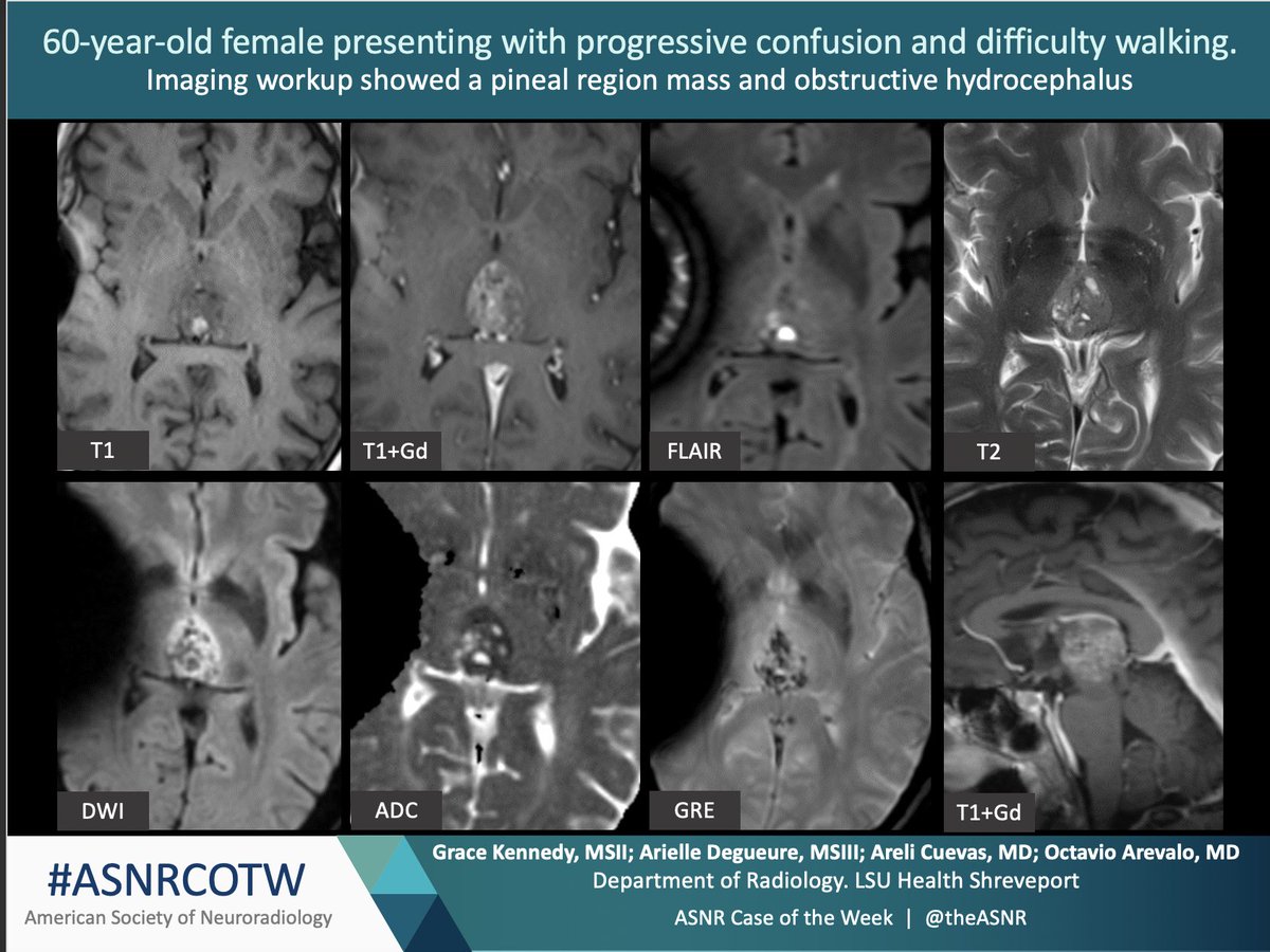 TheASNR's tweet image. ASNR COTW #114
History of progressive confusion and difficulty walking.     Remember NO SPOILERS! Give hints in the form of GIFs or answer the attached poll. Answer in 24 hours.