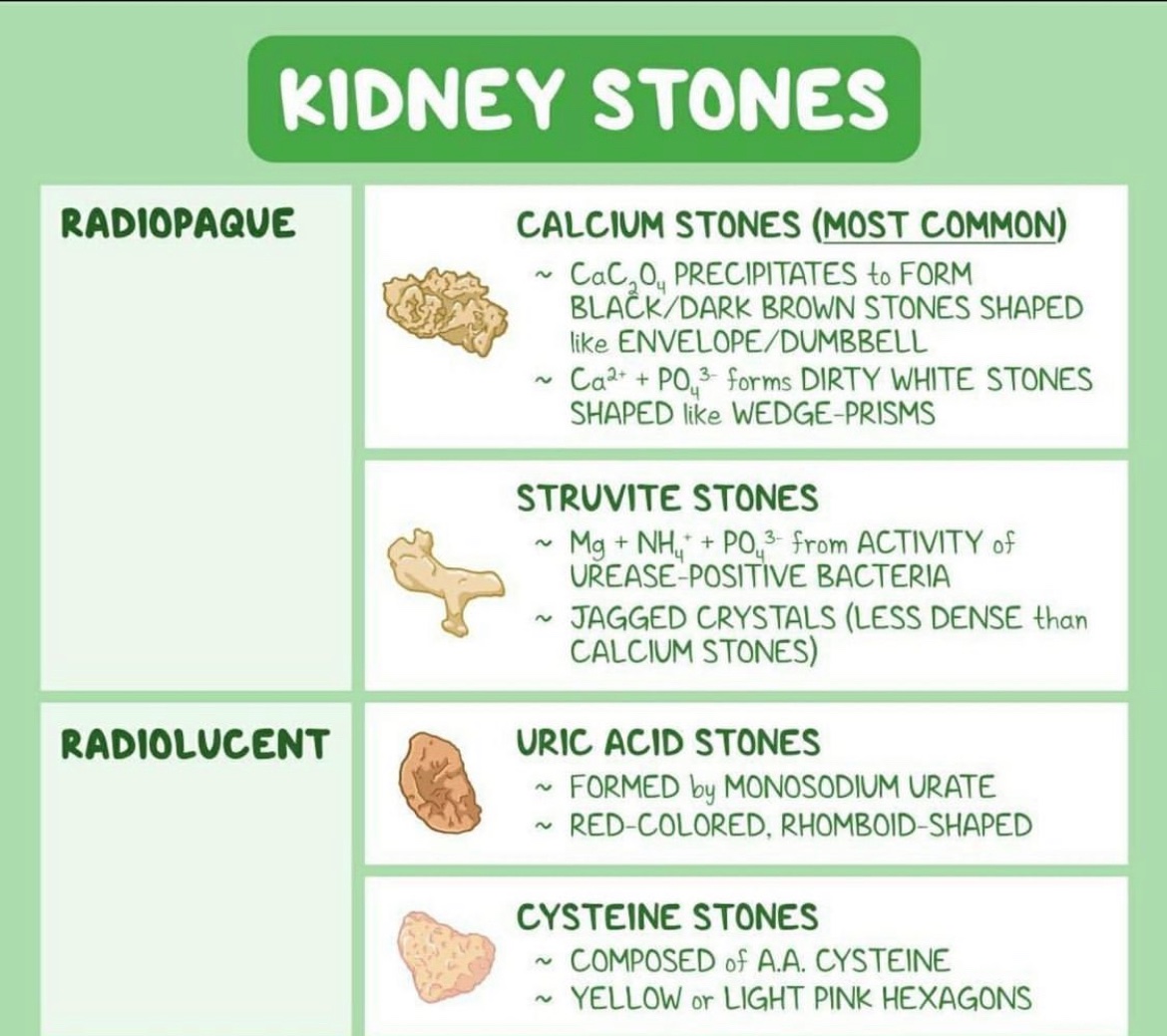Kidney stones <a href="/OsmosisMed/">Osmosis from Elsevier</a> #BJHM #MedEd #Medtwitter #FOAMed