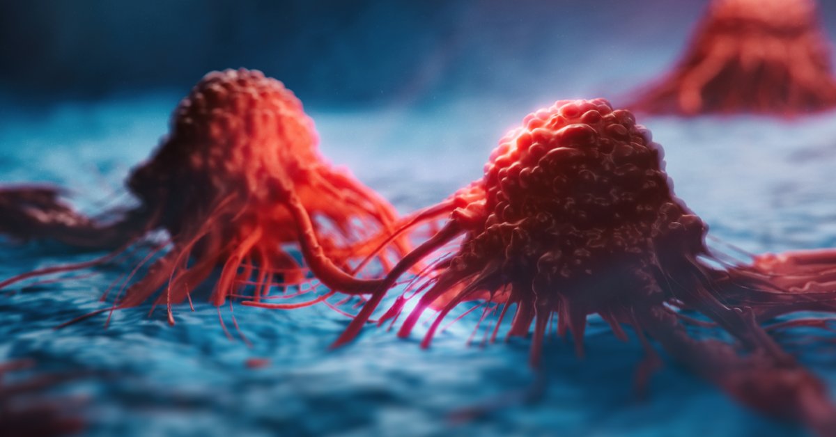 NCCN's tweet image. A new @JNCCN study suggests a method to predict outcomes with high accuracy prior to surgery for pancreatic cancer patients. 
Learn more: nccn.org/home/news/news…
@MayoCancerCare #pancsm