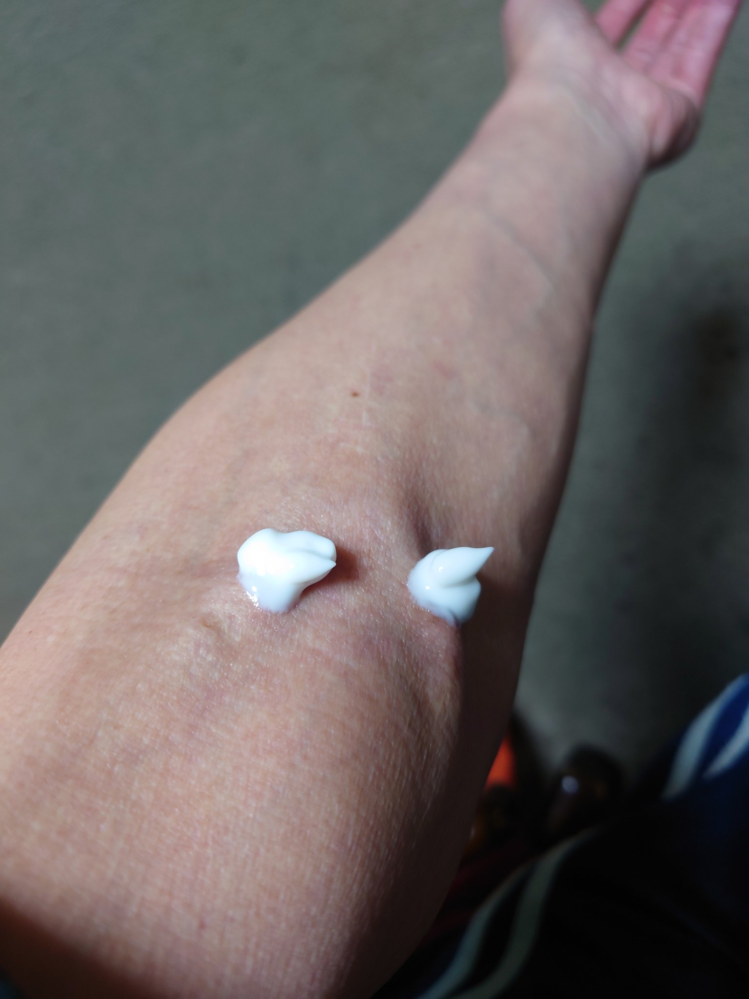 Twitter এ 守山宿 透析ルーティーン いつものように軽い麻酔が効くエムラクリームをてんこ盛り シールを貼って準備完了 これで透析モードに頭が切り替わる 正味4時間頑張る 透析準備 T Co Wotxyl1c9y ট ইট র